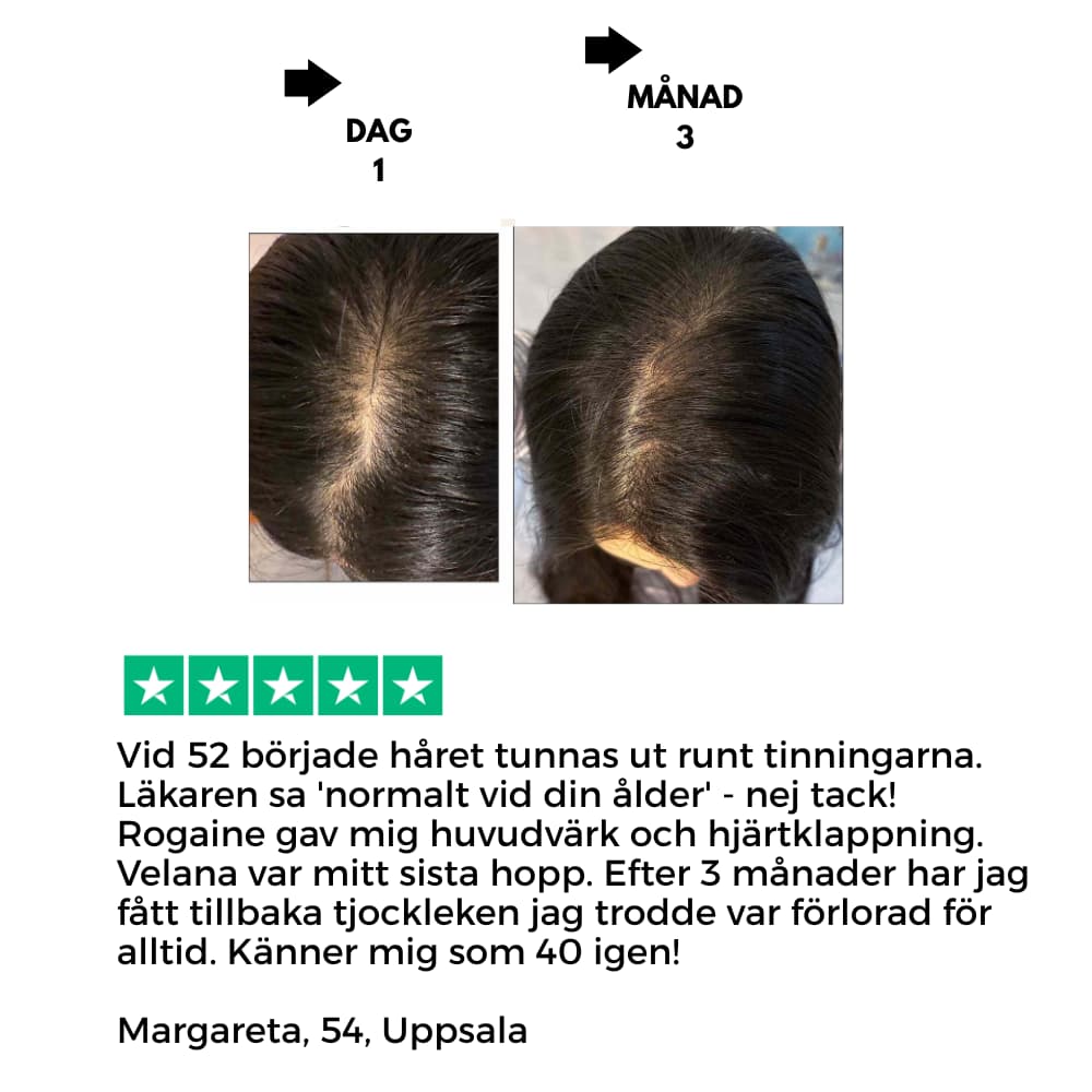 Velana Hairflow pro serum roll on