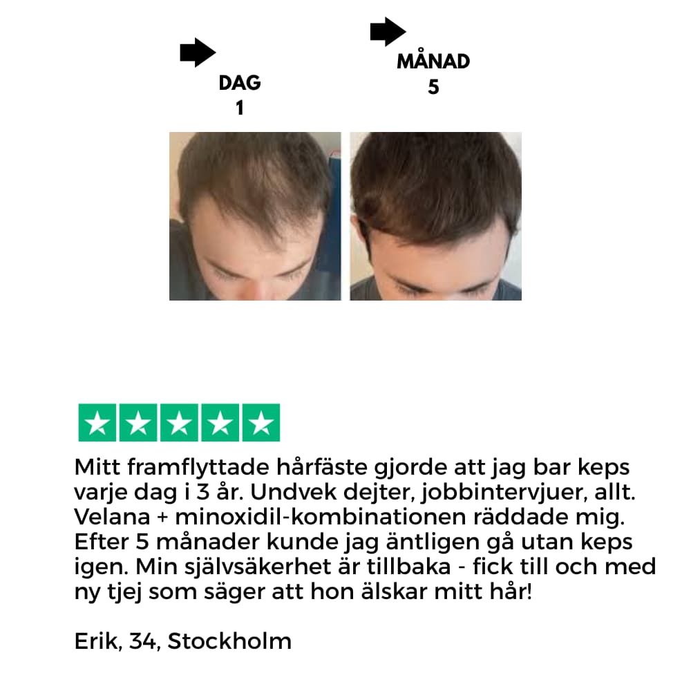 Velana Hairflow pro serum roll on