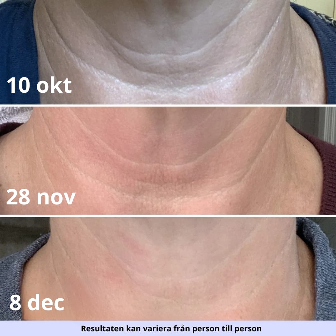 Velanabeauty cream
